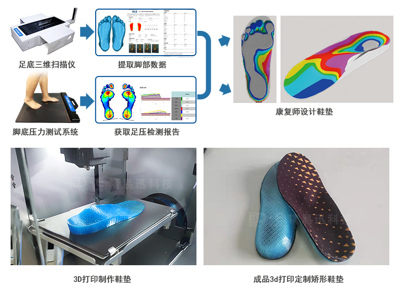 足底三维扫描仪-定制3D打印矫形鞋垫.jpg